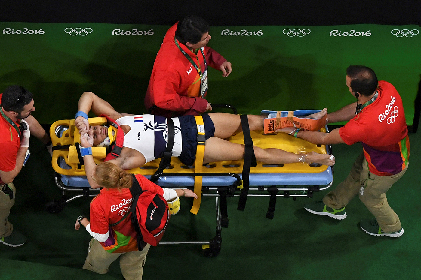 The Injured Athlete 第二版 What we can learn about bones from Olympic gymnast's gruesome