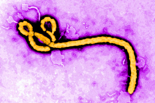 This undated colorized transmission electron micrograph image made available by the Centers for Disease Control and Prevention shows an Ebola virion. A Liberian woman who probably caught Ebola in 2014 may have infected three relatives a year after she first fell sick, doctors reported in a study published in July. (Frederick Murphy/CDC via AP, File)