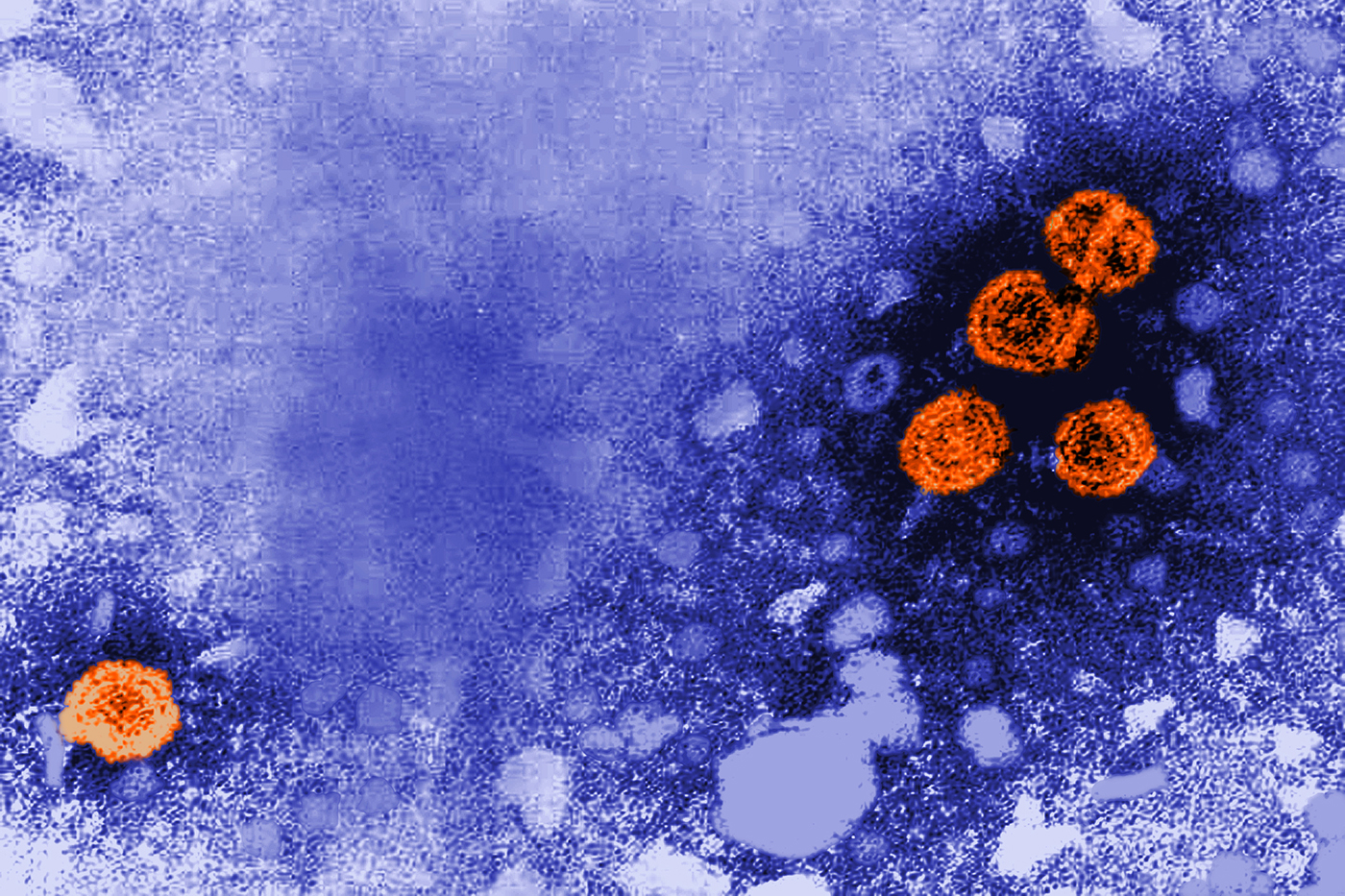 orange hepatitis b virus particles on a purple and blue background