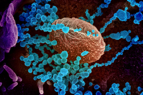 This image shows SARS-CoV-2 (round blue objects) emerging from the surface of cells cultured in the lab. SARS-CoV-2 is the virus that causes COVID-19. The virus shown was isolated from a patient in the U.S. Photo by: National Institute of Allergy and Infectious Diseases