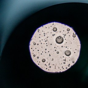 bacteria under a microscope