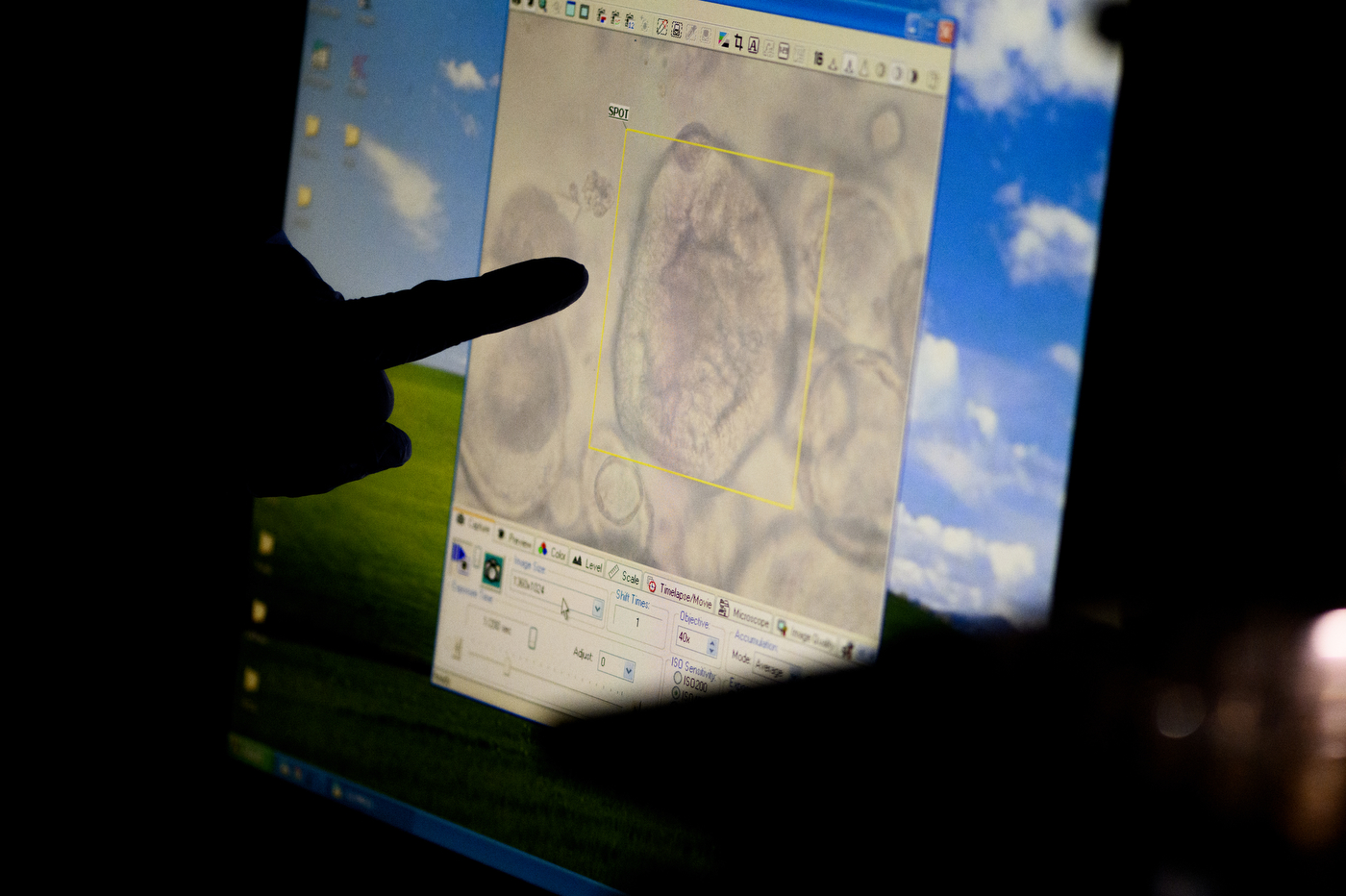 finger pointing to miscroscopic image enlarged on computer screen