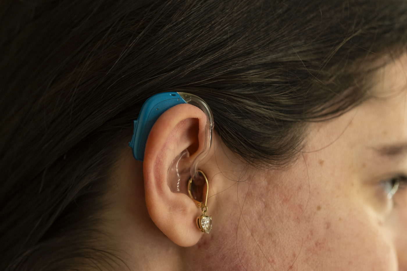 Rosenfeld's hearing aid