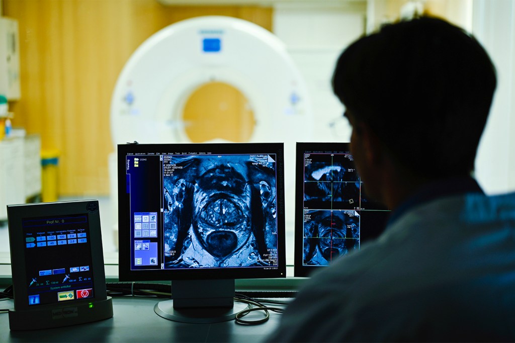 Silhouette of staff member looking at an image of a prostate on a monitor.