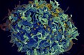 An electron microscope image that shows a human T cell, in blue, under attack by HIV, in yellow, the virus that causes AIDS.