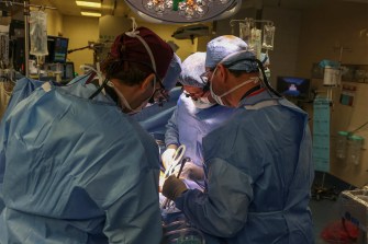Three surgeons performing a kidney transplant.