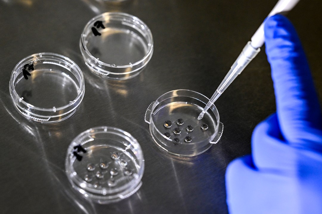 A person using a syringe on 4 small petri dishes.