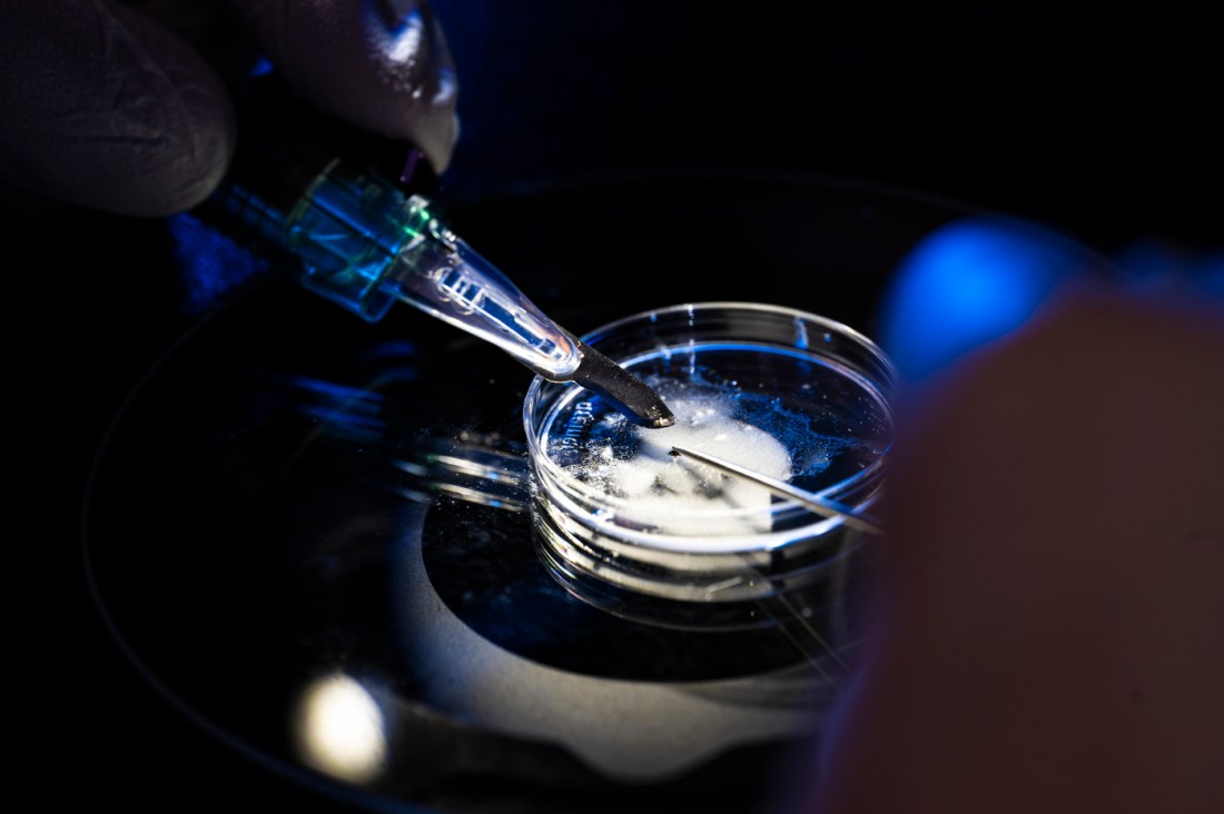 A person adjusting a tick on a petri dish. 