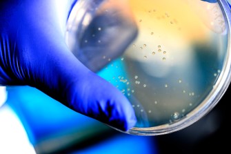 Gloved hand holding a petri dish with bacterial culture.