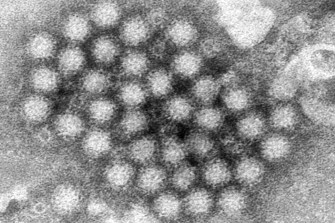 The norovirus virions seen under a microscope.