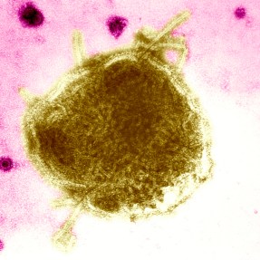 A measles virus shown under a microscope. It looks like a yellow blob on a pink background.