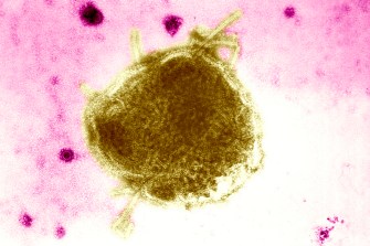 A measles virus shown under a microscope. It looks like a yellow blob on a pink background.