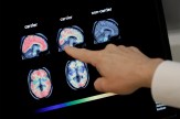 A hand pointing to a PET brain scan on a digital screen.