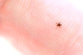 A tiny insect crawls on human skin.