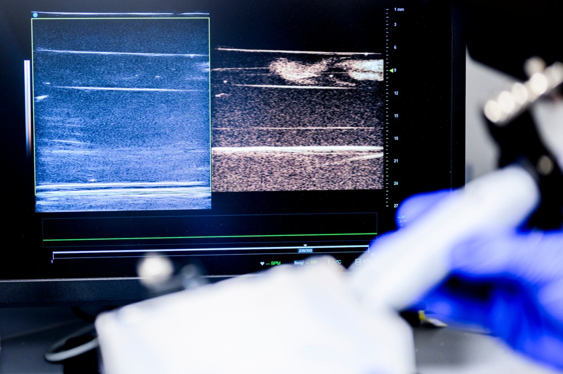 Ultrasound imaging display showing real-time brain scan data.