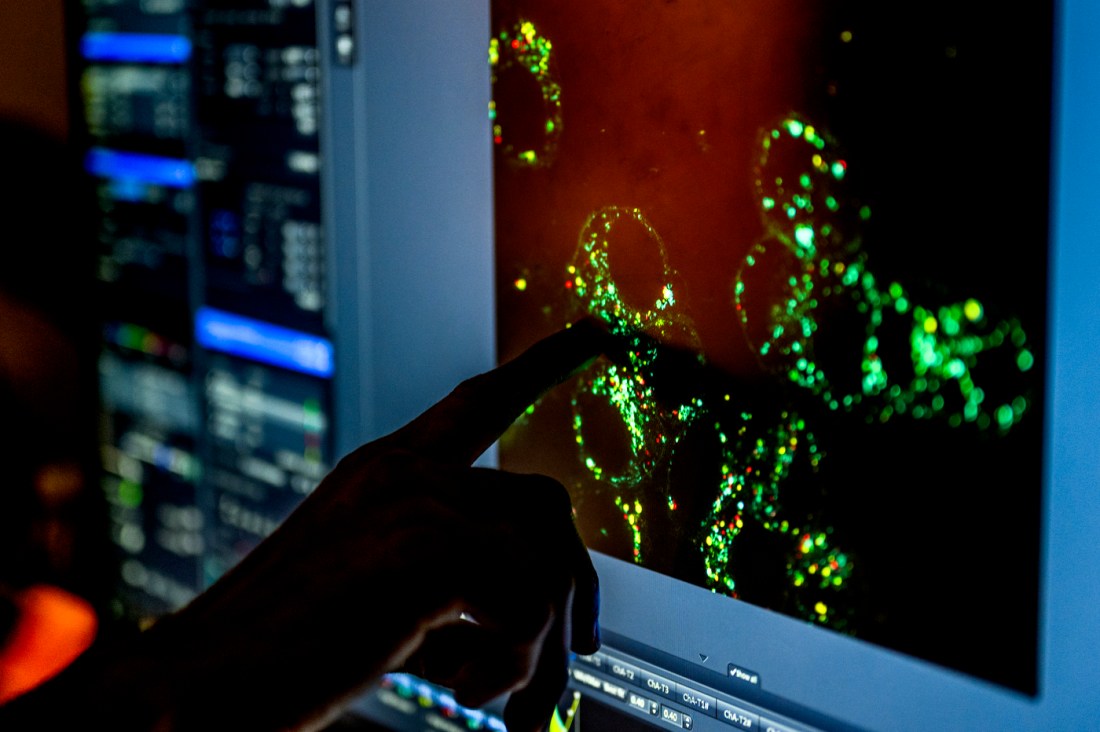Tao Sun's silhouetted hand pointing at a fluorescent imaging display on a screen showing active immune cells in ultrasound therapy research.