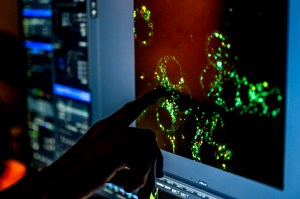 Tao Sun's silhouetted hand pointing at a fluorescent imaging display on a screen showing active immune cells in ultrasound therapy research.