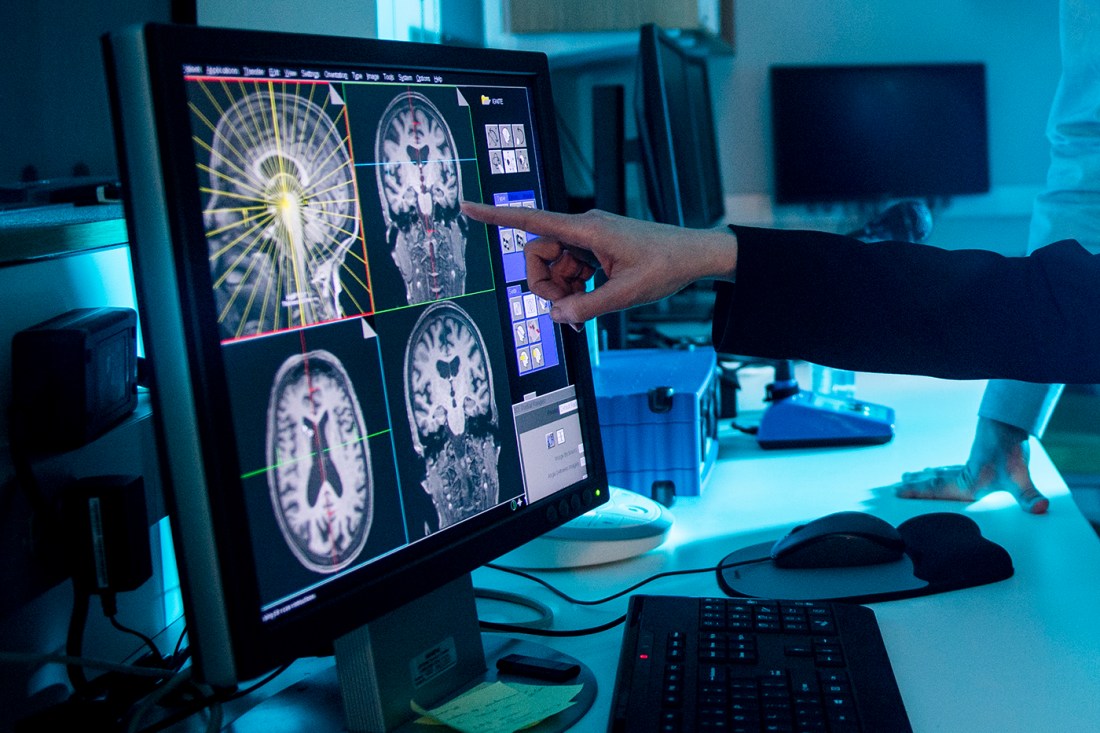 A researcher pointing to a screen displaying images of the brain.