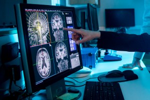 A researcher pointing to a screen displaying images of the brain.