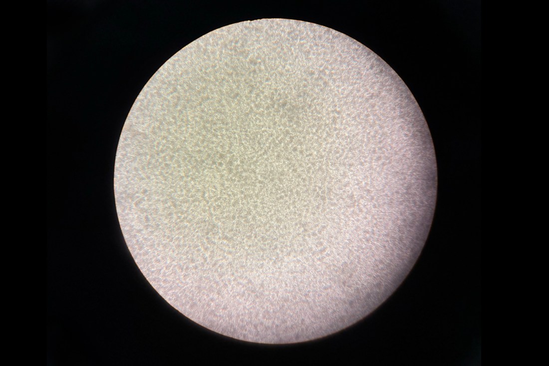 A microscopic view showing a densely packed field of cells related to research on CAR T-cell therapy.