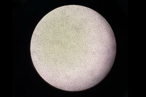 A microscopic view showing a densely packed field of cells related to research on CAR T-cell therapy.