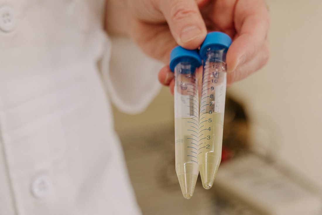 A hand holding two plastic pipettes or droppers with blue caps, each containing a pale yellow liquid. 