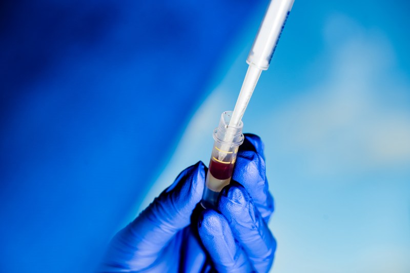 A close-up of a person wearing blue gloves holding a vial of blood and a pipette. 