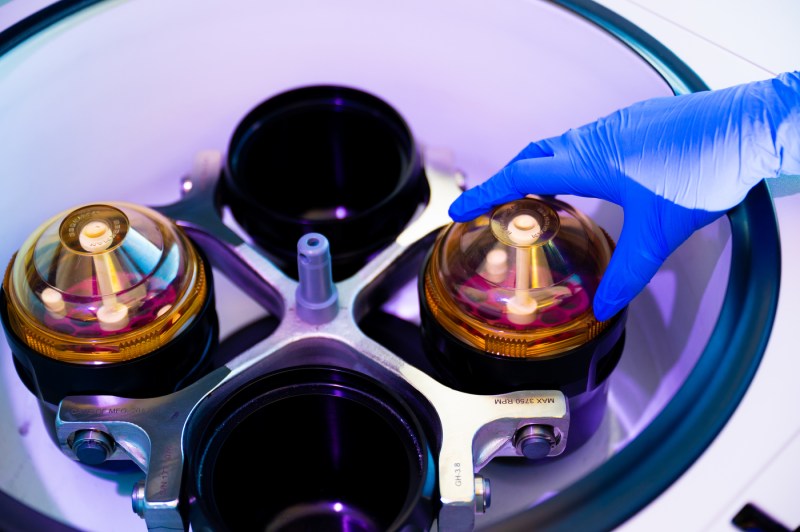 A close-up photo of a machine holding vials of blood. 