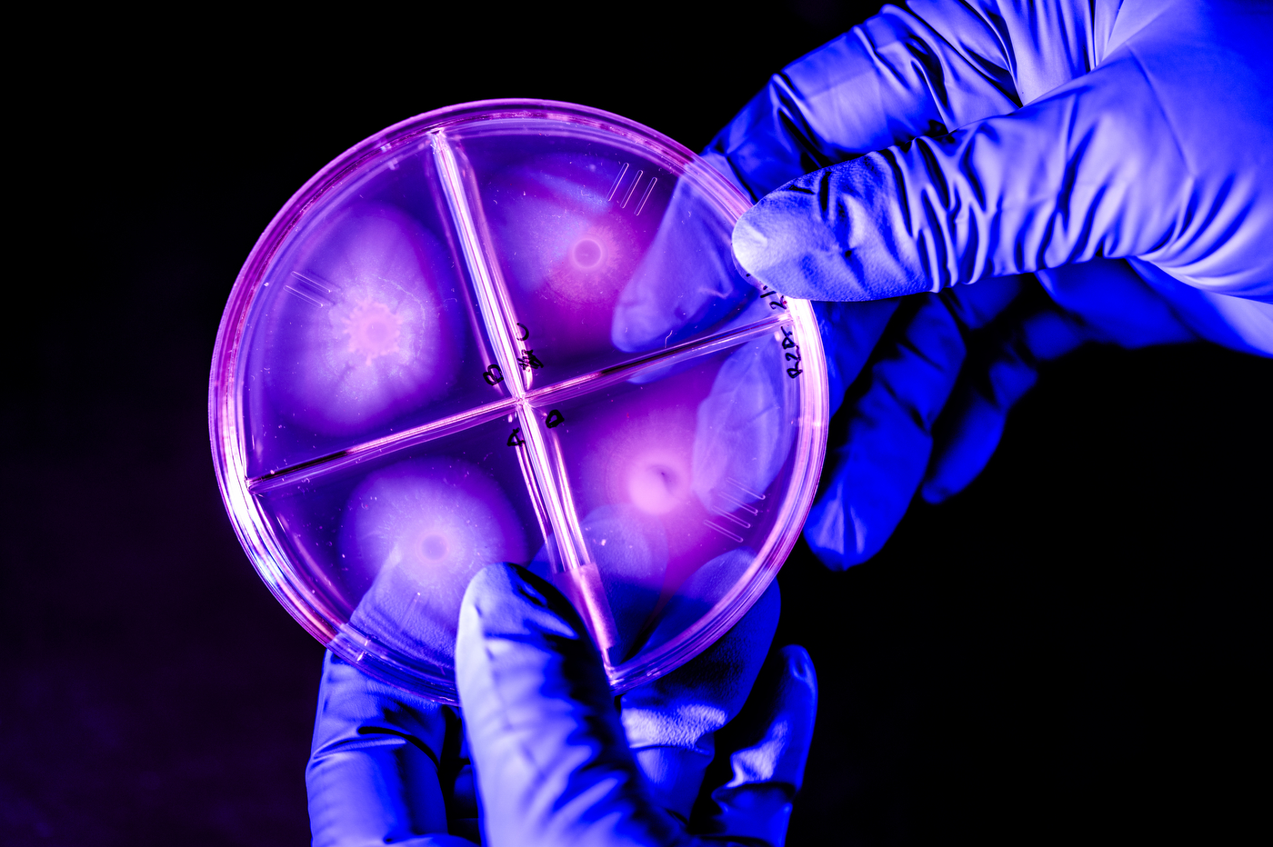 Gloved hands hold a petri dish divided into four quadrants with pink bacterial colonies against a purple-lit background. 