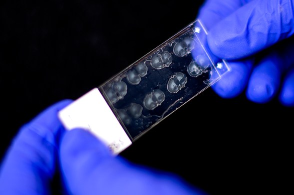 A pair of gloved hands holds a glass sample that contains thin slices of rat brains.
