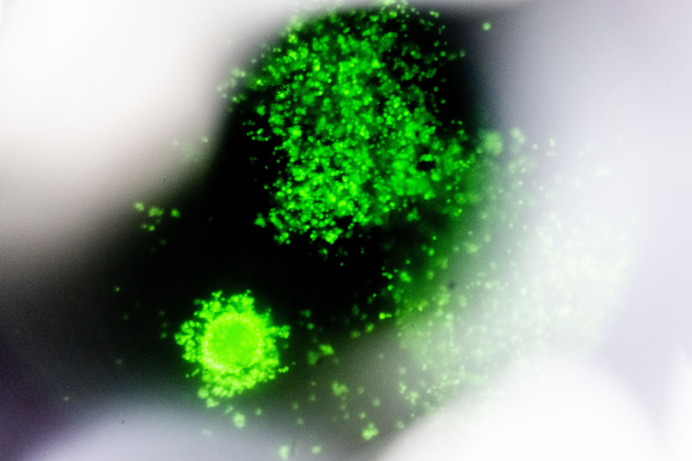 Fluorescence microscopy image of cells glowing green against a dark background.