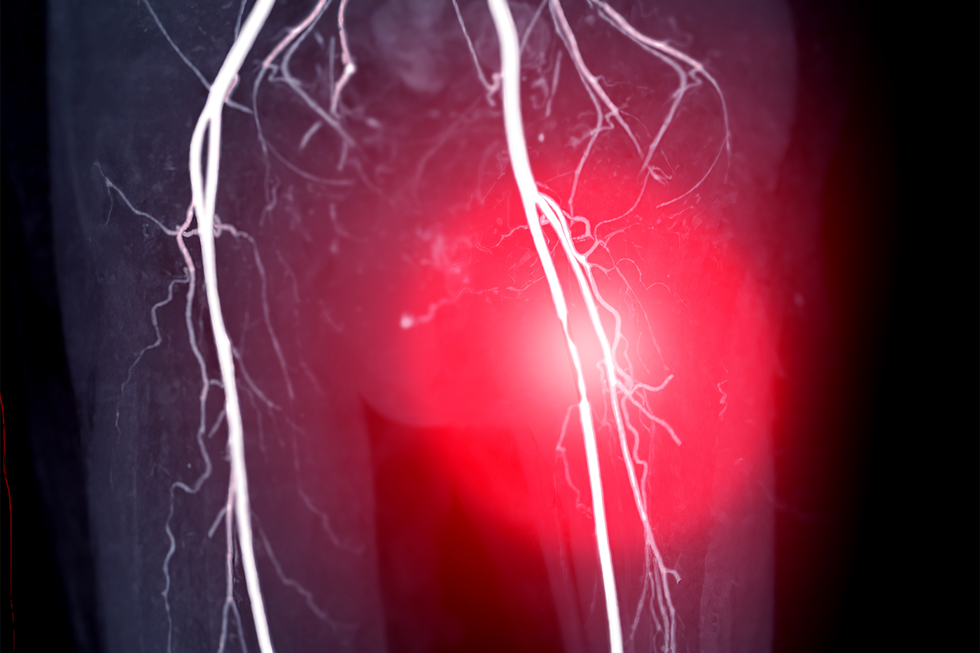 This research could help patients avoid amputations
