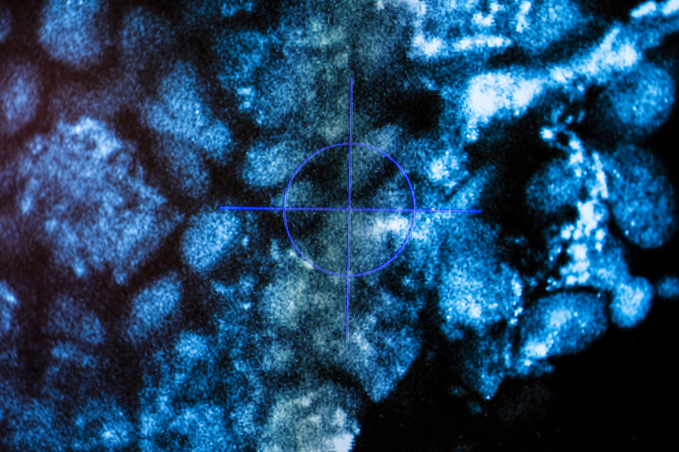 Fluorescent microscopy image of axolotl limb tissue, showing cell nuclei in blue against a dark background.