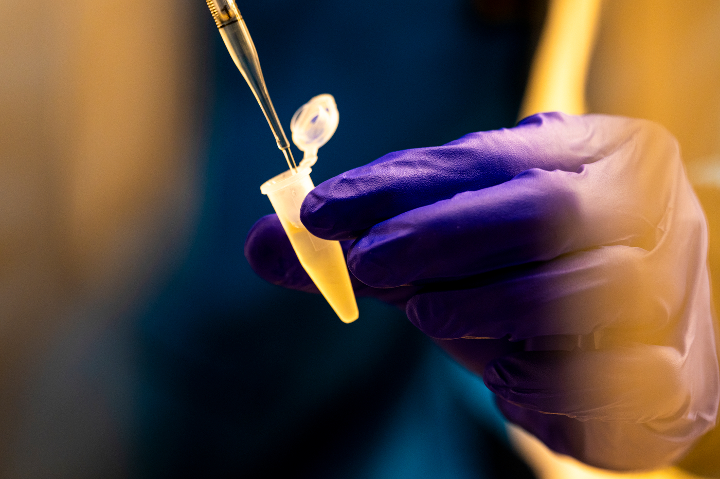 A close up of hands wearing purple gloves measuring a yellow liquid.