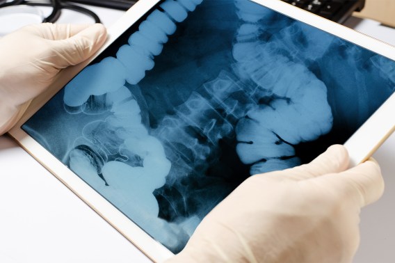 Gloved hands hold a tablet showing a blue-tinted X-ray of the colon, with a stethoscope on the desk behind.