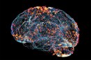 An image scan of neural brain connections, with colorful webs criss crossing the brain.